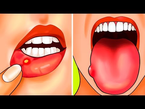 Видео о препарате Медивитан (Medivitan) 4мл 1мл ампулы 8шт